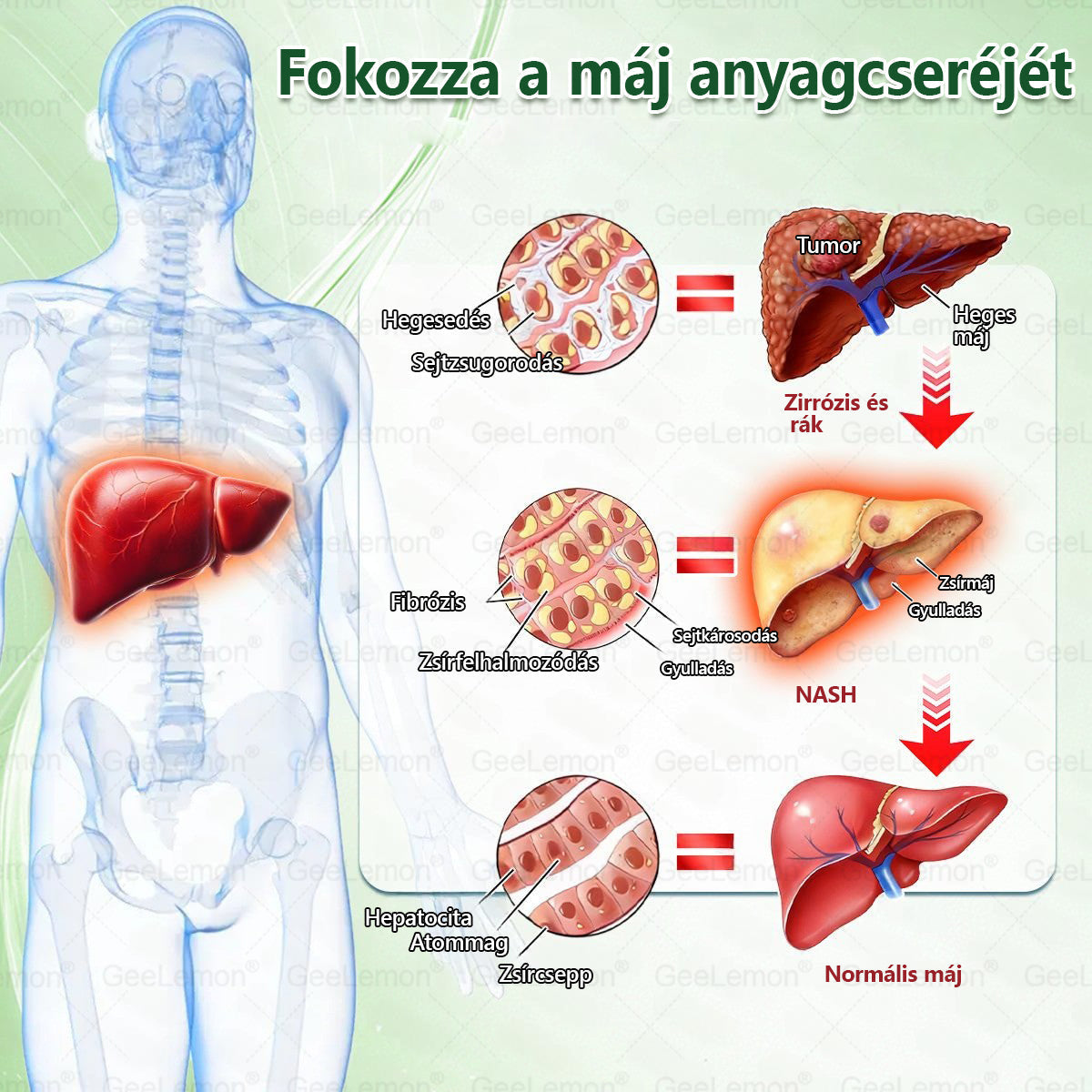 | 🇭🇺Hivatalos magyar márkabolt 🎁 𝐂𝐥𝐞𝐚𝐫𝐞𝐧𝐚® Glumasetide 10 az 1-ben Karcsú és Egészséges Nano Mikrotűs Tapasz 🌿