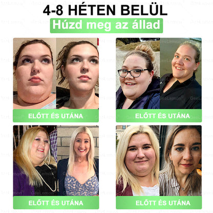 | 🇭🇺Hivatalos magyar márkabolt 🎁 𝐂𝐥𝐞𝐚𝐫𝐞𝐧𝐚® Glumasetide 10 az 1-ben Karcsú és Egészséges Nano Mikrotűs Tapasz 🌿