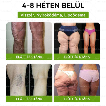 | 🇭🇺Hivatalos magyar márkabolt 🎁 𝐂𝐥𝐞𝐚𝐫𝐞𝐧𝐚® Glumasetide 10 az 1-ben Karcsú és Egészséges Nano Mikrotűs Tapasz 🌿