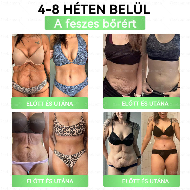 | 🇭🇺Hivatalos magyar márkabolt 🎁 𝐂𝐥𝐞𝐚𝐫𝐞𝐧𝐚® Glumasetide 10 az 1-ben Karcsú és Egészséges Nano Mikrotűs Tapasz 🌿